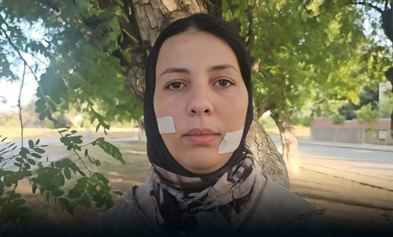 سنتان ونصف سجناً للمتهم بتشويه وجه خديجة