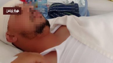 سيدي محمد الحمر.. ضحية اعتداء يكشف معاناته بعد حكم قضائي أثار الجدل